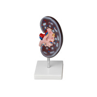 Модель почки в разрезе - «globural.ru» - Воркута