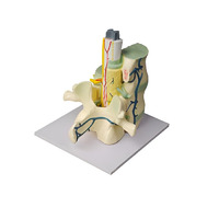 Модель части позвоночника человека - «globural.ru» - Воркута