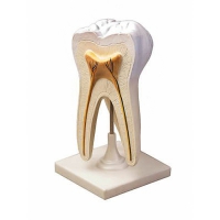 Модель строения зуба - «globural.ru» - Воркута