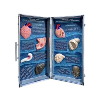 Учебно-демонстрационный кейс "Последствия употребления алкоголя и наркотиков" - «globural.ru» - Воркута