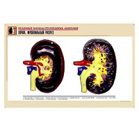 Рельефная таблица "Почка. Фронтальный разрез" (формат А1, матовое ламинир.) - «globural.ru» - Воркута